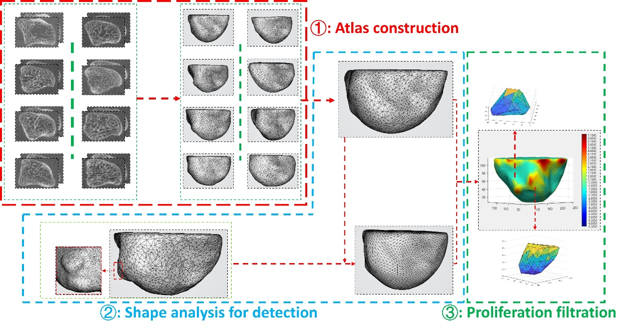 Workflow of bone proliferation detection algorithm